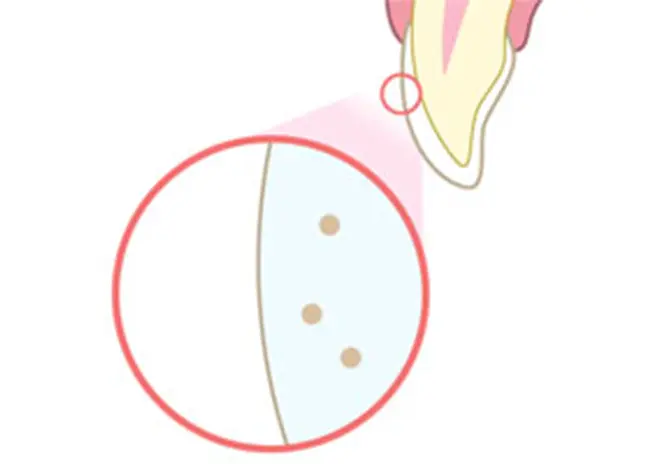 歯本来の白さを引き出す