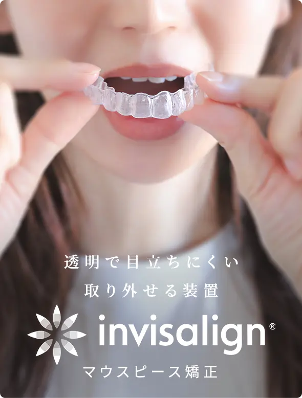 マウスピース矯正　invisalign