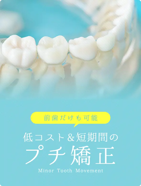 低コスト＆短期間のプチ矯正