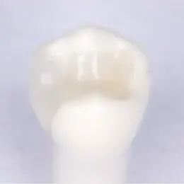 セラミック