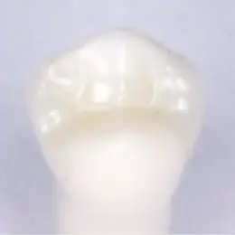 ジルコニア