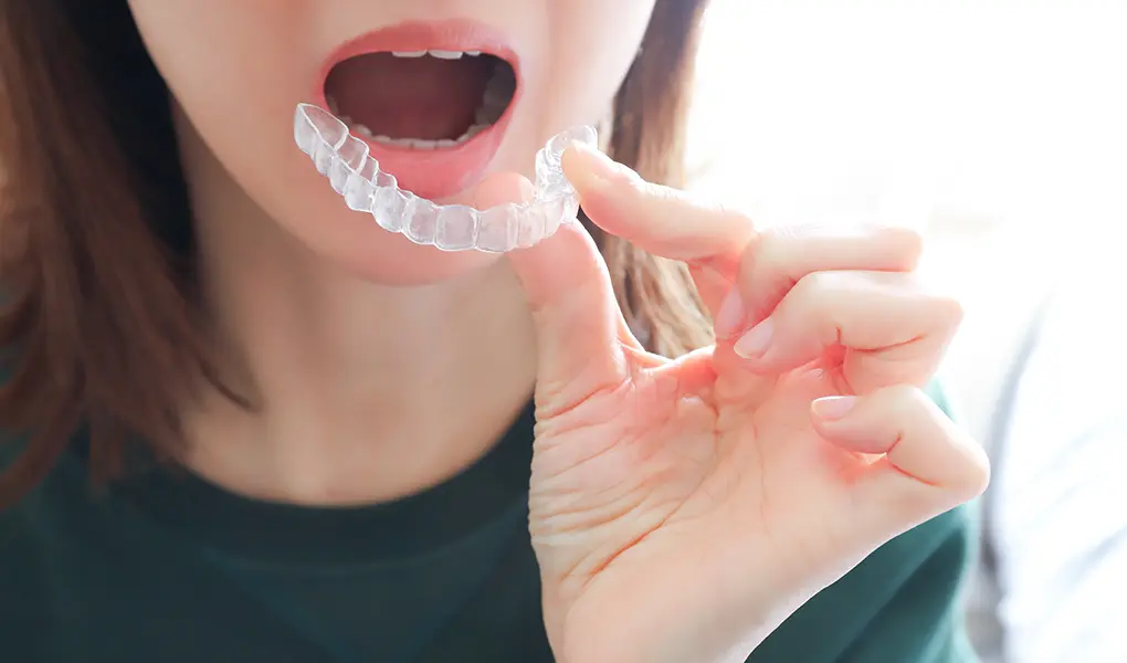 矯正治療