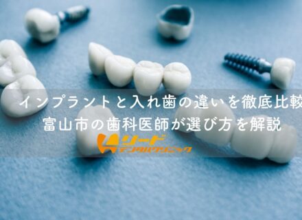 インプラントと入れ歯の違いを徹底比較|富山市の歯科医師が選び方を解説