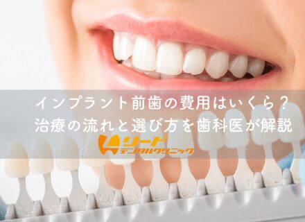 インプラント前歯の費用はいくら？治療の流れと選び方を歯科医が解説