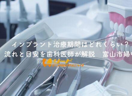 インプラント治療期間はどれくらい？流れと目安を歯科医師が解説｜富山市婦中