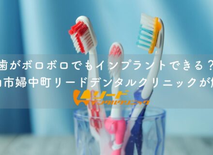 歯がボロボロでもインプラントできる?富山市婦中町リードデンタルクリニックが解説